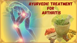 Herbal Treatment for Arthritis