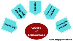 Causes of Leucorrhoea