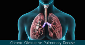 chronic obstructive pulmonary disease (copd)
