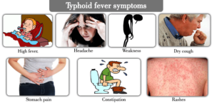 Preventive Measures for Typhoid Fever