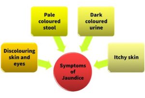 Jaundice Symptoms