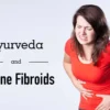Uterine Fibroid Ayurvedic Treatment