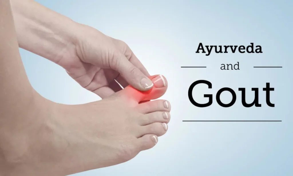 ayurvedic treatment of gout
