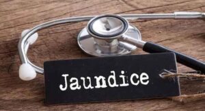 Ayurvedic treatment of jaundice