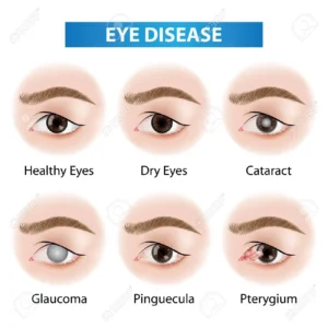 indications of eye diseases